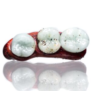 Shop Zii - Partial Denture Pendant - Molars in australian